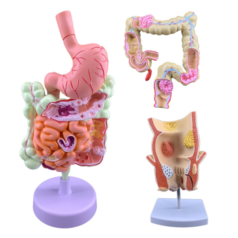Q6PA 3D 病理学教育モデル、研究室観察、教室での説明お - Medical Lab Observer のレビューと価格